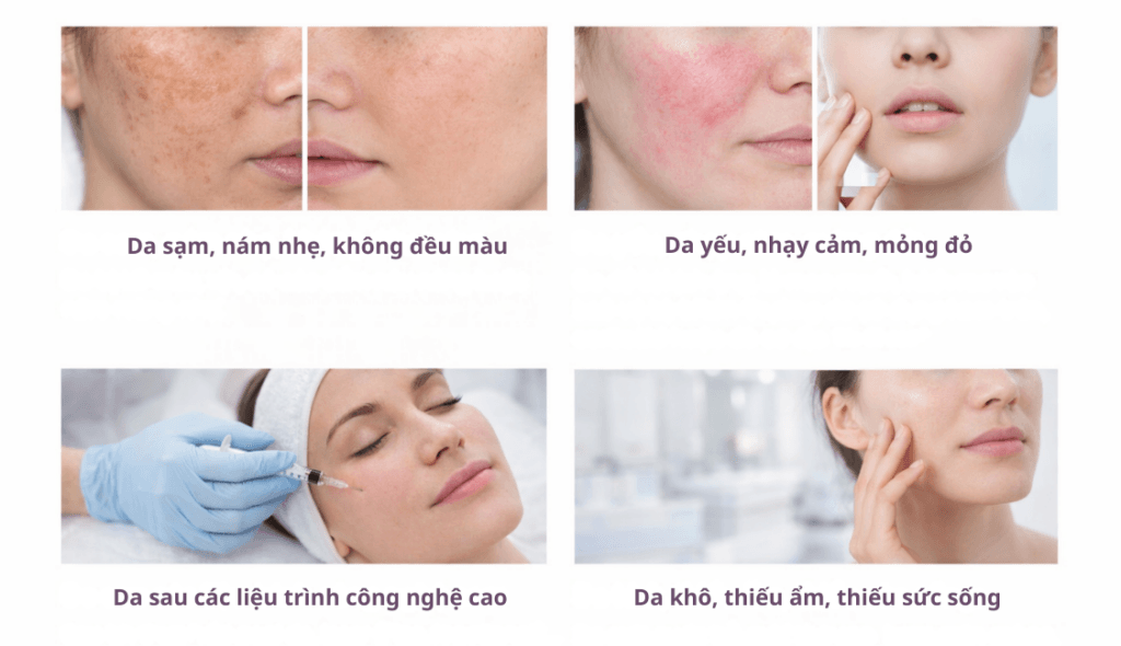 Các trường hợp phù hợp để sử dụng meso femi glu 8