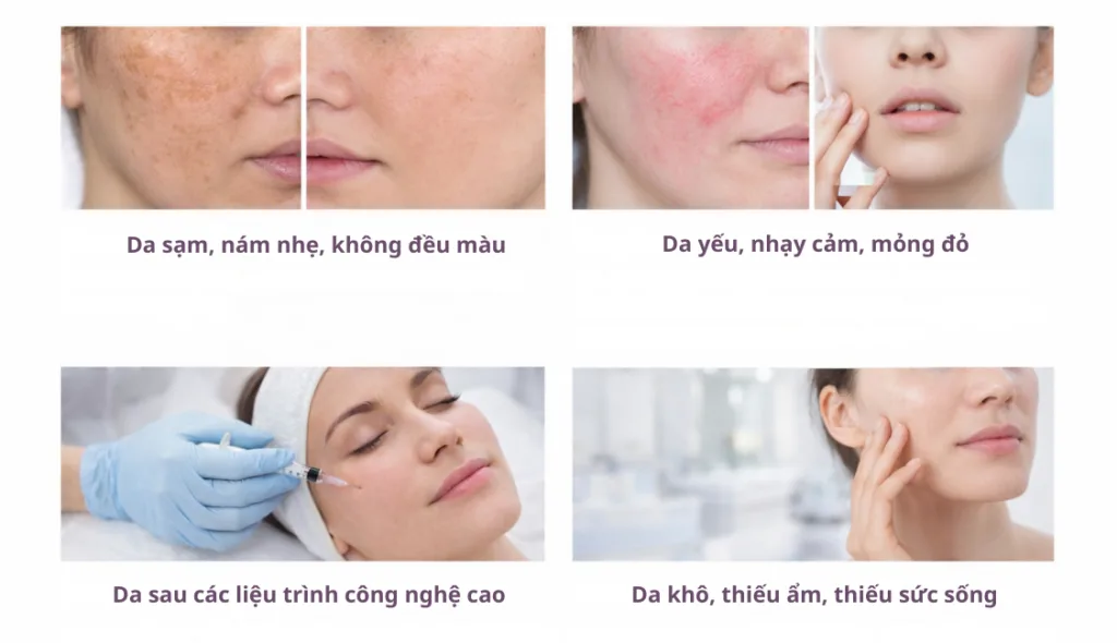 Các trường hợp phù hợp để sử dụng meso femi glu 8