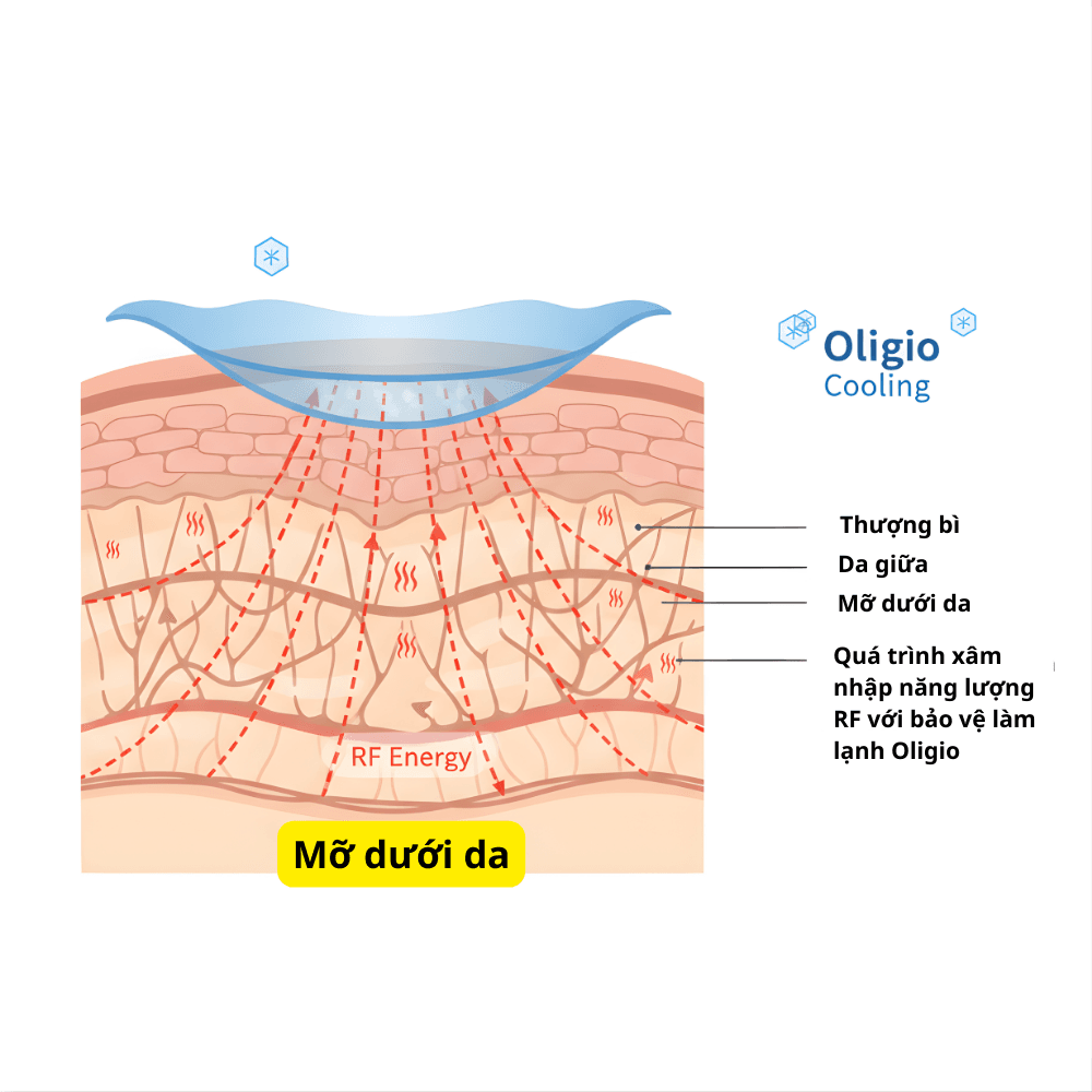 Sơ đồ minh họa cắt ngang da, làm nổi bật sóng RF đi sâu vào trung bì, nhưng bề mặt da được làm lạnh và bảo vệ nhờ hệ thống làm mát của Oligio.