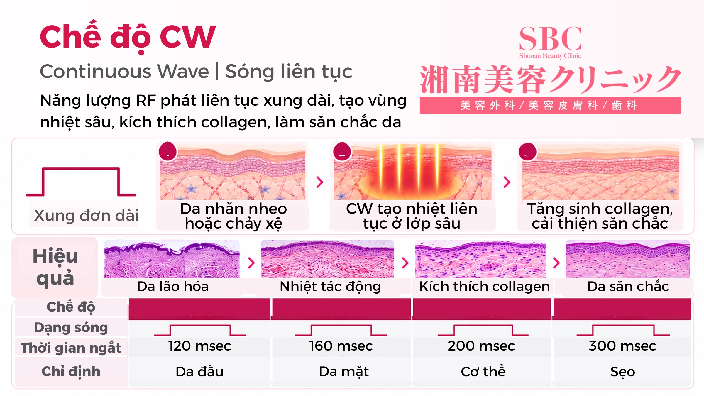 Vi kim RF Sylfirm X tại SBC: Bảng giá & Thông tin chi tiết 3 Cơ chế hoạt động của sóng liên tục CW hỗ trợ điều trị lão hóa và nếp nhăn quanh mắt