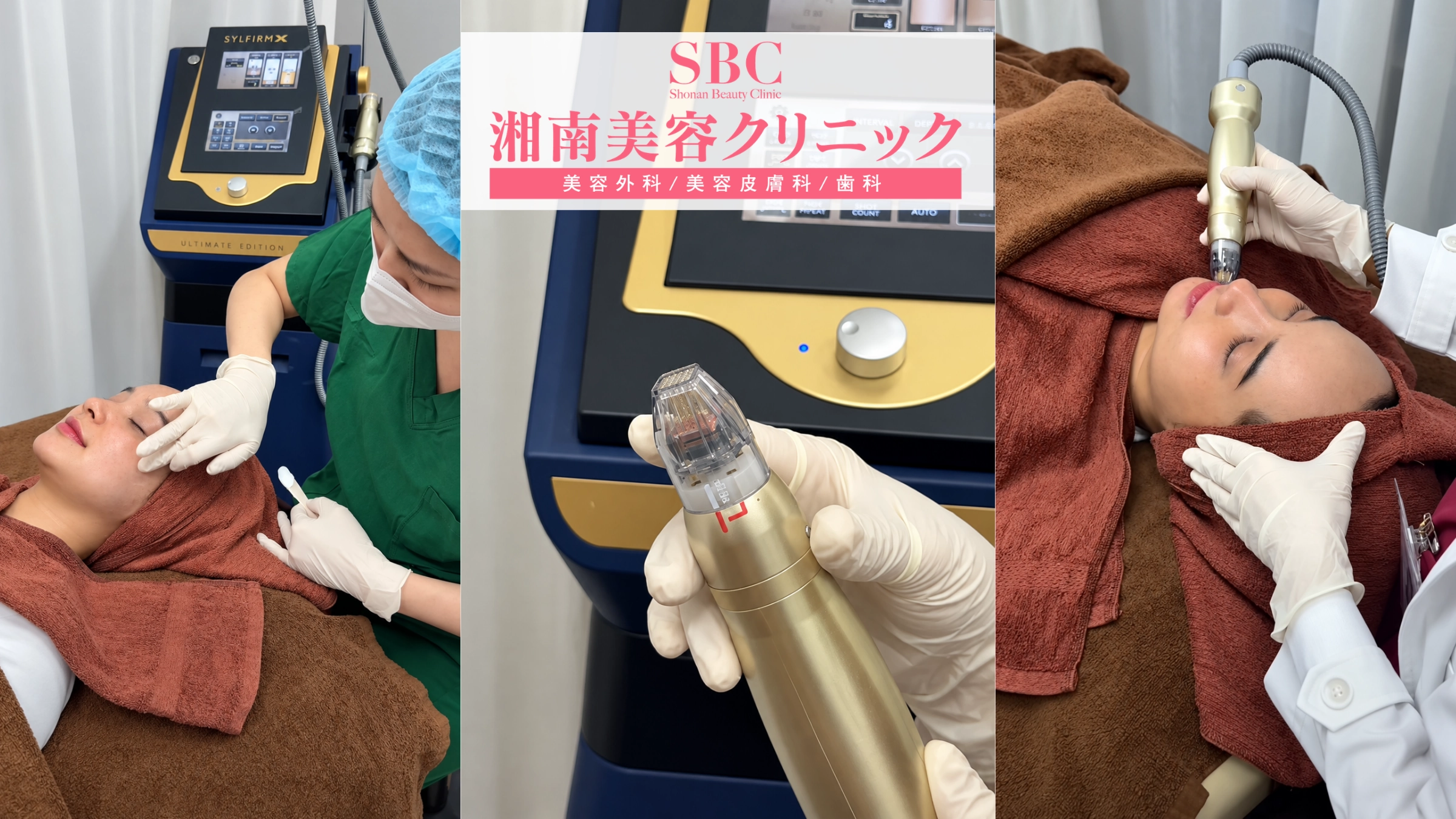 Vi kim RF Sylfirm X tại SBC: Bảng giá & Thông tin chi tiết 5 Khách hàng điều trị sử dụng công nghệ vi kim RF Sylfirm tại SBC