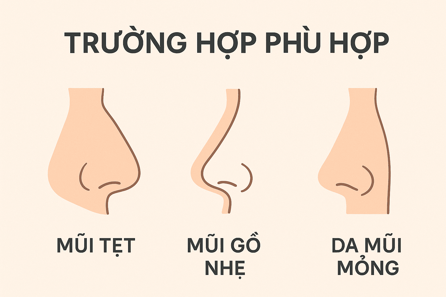 Nâng Mũi Sụn Surgiform: Dáng Mũi Tự Nhiên & Bền Vững 3 Ảnh minh hoạ: Các trường hợp mũi phù hợp để nâng sụn Surgiform
