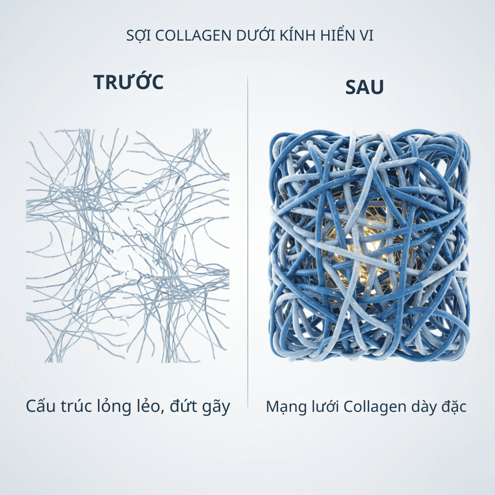 Ảnh minh họa quá trình tái cấu trúc và tăng sinh Collagen mới sau khi vi kim RF.