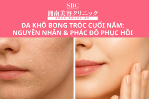 Ảnh minh họa tình trạng Da khô bong tróc cuối năm và quy trình phục hồi hàng rào bảo vệ da chuyên sâu tại SBC.