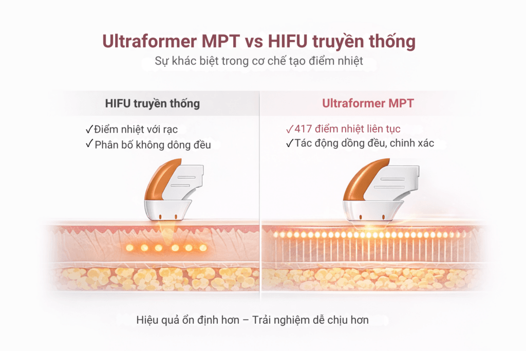 So sánh chế độ phát xung Line Mode của Ultraformer MPT và HIFU truyền thống