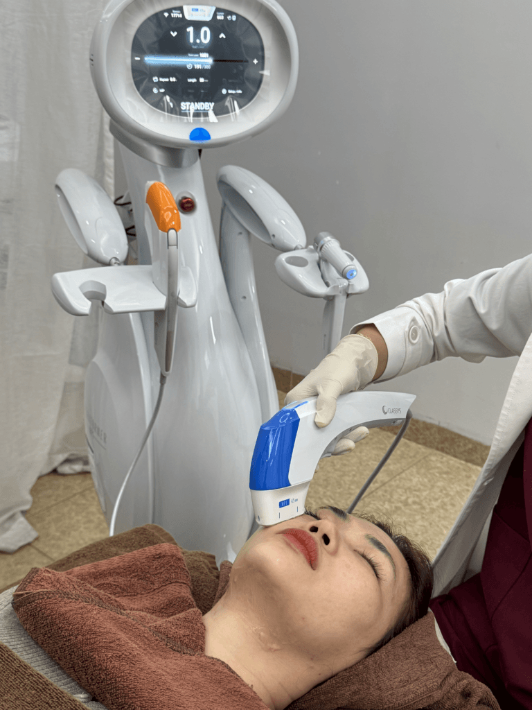 Siêu phẩm nâng cơ Ultraformer MPT thế hệ thứ 4 tại Viện thẩm mỹ SBC