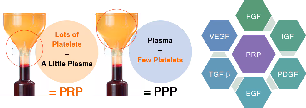 about PRP 01