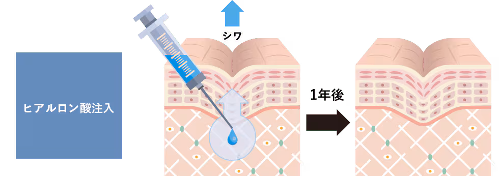 aboutPRP03