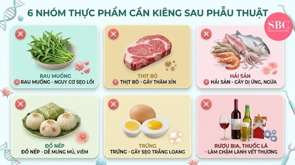 Cắt Mí Kiêng Ăn Gì? Thực Đơn 14 Ngày Giúp Mí Lành Đẹp 2 Ảnh minh hoạ: 6 nhóm thực phẩm cần kiêng sau khi cắt mí.