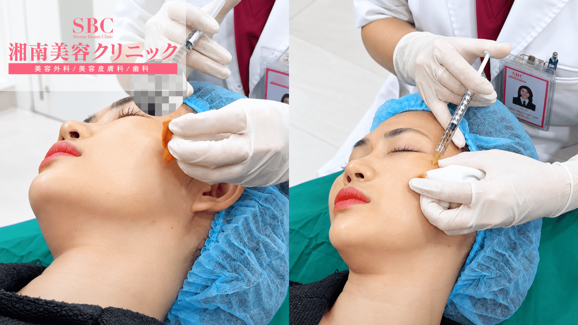 PRP/PRF tái tạo da tại SBC - Bảng giá & Thông tin chi tiết 3 Bác sĩ tại SBC tiêm liệu pháp PRP/PRF cho người điều trị